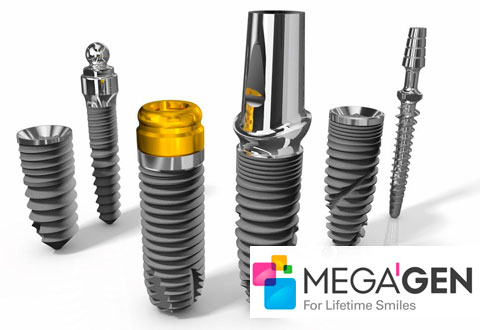 MegaGen (МегаДжен) - корейські імплантати середньої ціни